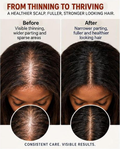 IJE Botanical Hair Oil 100ml bottle